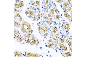 Immunohistochemistry of paraffin-embedded human gastric using FECH antibody at dilution of 1:100 (x40 lens). (FECH anticorps)