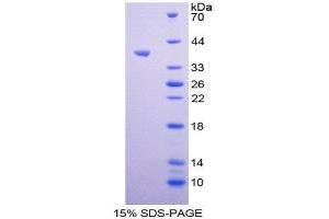 SDS-PAGE (SDS) image for Arachidonate 12-Lipoxygenase (ALOX12) (AA 352-656) protein (His tag) (ABIN1981034)