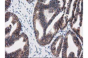 Image no. 1 for anti-Catenin (Cadherin-Associated Protein), beta 1, 88kDa (CTNNB1) antibody (ABIN1496893)