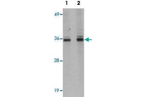 Western blot analysis of HepG2 cells with RSRC1 polyclonal antibody  at (Lane 1) 1 and (Lane 2) 2 ug/mL dilution. (RSRC1 anticorps  (C-Term))