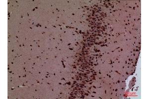 Immunohistochemistry (IHC) analysis of paraffin-embedded Mouse Brain, antibody was diluted at 1:100.