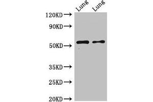 Western Blot Positive WB detected in: Rat lung tissue, Mouse lung tissue All lanes: HTR3A antibody at 2. (Serotonin Receptor 3A anticorps  (AA 322-455))