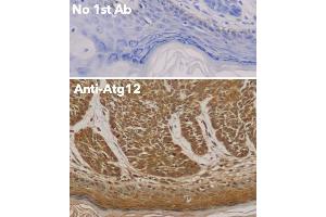 Immunohistochemistry (IHC) image for anti-Autophagy Related 12 (ATG12) (N-Term) antibody (ABIN6254241) (ATG12 anticorps  (N-Term))