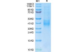 Biotinylated Human NKG2C on Tris-Bis PAGE under reduced condition.