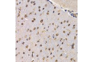 Immunohistochemistry of paraffin-embedded mouse brain using RAD1 antibody (ABIN6290854) at dilution of 1:200 (40x lens). (RAD1 anticorps)