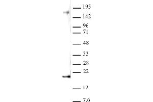 Histone H3 dimethyl Lys27 antibody (pAb) tested by Western blot. (Histone 3 anticorps  (2meLys27))