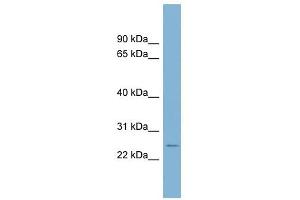 CD160 antibody used at 1 ug/ml to detect target protein. (CD160 anticorps  (Middle Region))