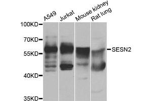 Western blot analysis of extracts of various cell lines, using SESN2 antibody (ABIN4905132) at 1:1000 dilution.