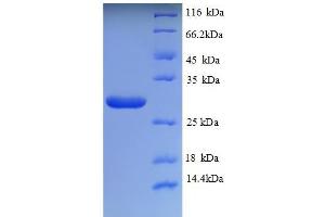 SDS-PAGE (SDS) image for Trehalase (Brush-Border Membrane Glycoprotein) (TREH) (AA 3-221), (partial) protein (His tag) (ABIN5713138)