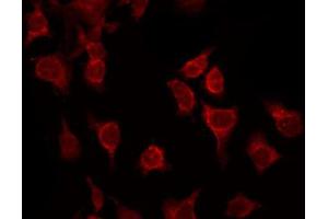 ABIN6267389 staining Hela by IF/ICC.