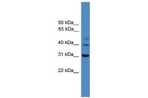 WB Suggested Anti-TRIB1  Antibody Titration: 0. (TRIB1 anticorps  (C-Term))