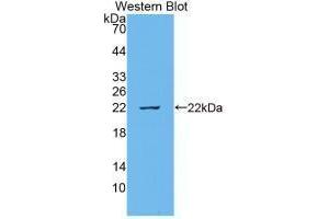 Western blot analysis of recombinant Cow IL18. (IL-18 anticorps  (AA 37-193))