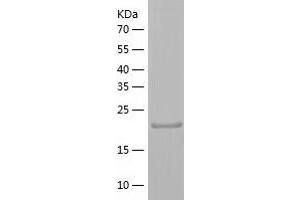 Western Blotting (WB) image for THAP Domain Containing, Apoptosis Associated Protein 3 (THAP3) (AA 1-239) protein (His-IF2DI Tag) (ABIN7125351)