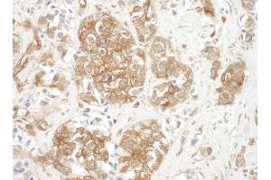 Immunohistochemistry (IHC) image for anti-Cortactin (CTTN) (AA 450-500) antibody (ABIN7448483)