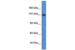 Western Blot showing Insr antibody used at a concentration of 1. (Insulin Receptor anticorps  (Middle Region))