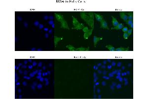 Sample Type :  HeLa   Primary Antibody Dilution:  4 ug/ml   Secondary Antibody :  Anti-rabbit Alexa 546   Secondary Antibody Dilution:  2 ug/ml   Gene Name :  BRD4 (BRD4 anticorps  (C-Term))