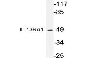 Western blot analysis of CD213a1 / IL13RA1 Antibody in extracts from COLOcells. (IL13 Receptor alpha 1 anticorps)