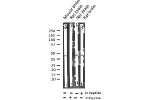 Western blot analysis of Phospho-SEK1/MKK4 (Ser80) expression in various lysates