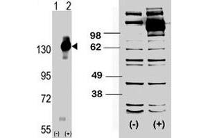 (LEFT) Western blot analysis of CSF1R (arrow) using rabbit CSF1R polyclonal antibody . (CSF1R anticorps  (C-Term))