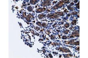 Immunohistochemical staining of paraffin-embedded Human breast tissue using anti-KHK mouse monoclonal antibody. (Ketohexokinase anticorps)