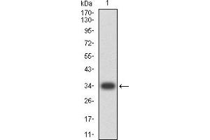 Western blot analysis using CD268 mAb against human CD268 (AA: extra 1-78) recombinant protein.