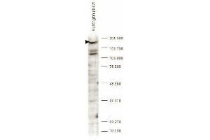 Western blot analysis is shown using anti-Huntingtin pS421 antibody to detect endogenous protein present in an unstimulated human PC-3 whole cell lysate (arrowhead). (Huntingtin anticorps  (pSer421))