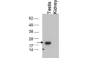 Image no. 1 for anti-Glutathione Peroxidase 4 (GPX4) (C-Term) antibody (ABIN401375) (GPX4 anticorps  (C-Term))