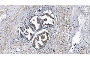 IHC analysis of STIL/SIL using anti-STIL/SIL antibody (ABIN7599923). (STIL anticorps  (AA 13-1287))