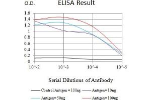 Black line: Control Antigen (100 ng),Purple line: Antigen (10 ng), Blue line: Antigen (50 ng), Red line:Antigen (100 ng) (IL15RA anticorps  (AA 31-205))