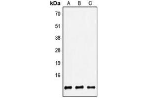 Western blot analysis of Defensin beta 2 expression in HEK293T (A), Raw264. (beta 2 Defensin anticorps  (Center))