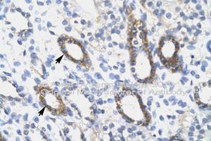 Image no. 2 for anti-SRY (Sex Determining Region Y)-Box 10 (SOX10) (AA 191-240) antibody (ABIN6746058)