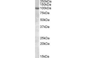 ABIN2564625 (1µg/ml) staining of HeLa lysate (35µg protein in RIPA buffer). (PKD2 anticorps  (Internal Region))