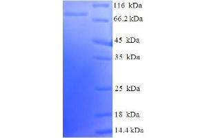 SDS-PAGE (SDS) image for Lymphocyte-Specific Protein tyrosine Kinase (LCK) (AA 1-539), (Isoform 3) protein (His-SUMO Tag) (ABIN5709839)