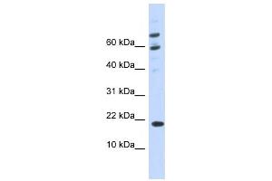 Western Blotting (WB) image for anti-BRWD1-AS2 antibody (ABIN2458959) (BRWD1-AS2 anticorps)