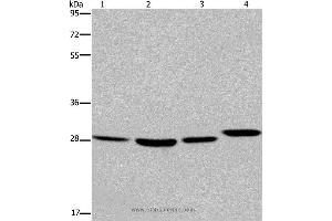 Western blot analysis of 293T and LoVo cell, mouse skin tissue and A172 cell, using ETV7 Polyclonal Antibody at dilution of 1:850 (ETV7 anticorps)
