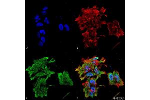 Immunocytochemistry/Immunofluorescence analysis using Mouse Anti-Alpha B Crystallin Monoclonal Antibody, Clone 3A10. (CRYAB anticorps  (HRP))