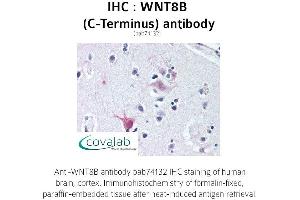 Image no. 1 for anti-Wingless-Type MMTV Integration Site Family, Member 8B (WNT8B) (C-Term) antibody (ABIN1740841) (WNT8B anticorps  (C-Term))
