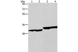 Western Blot analysis of Human endometrial carcinoma and colon cancer tissue, Human fetal liver tissue and PC3 cell using DECR1 Polyclonal Antibody at dilution of 1:300 (DECR1 anticorps)
