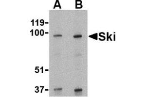 Western Blotting (WB) image for anti-SKI Proto-Oncogene (SKI) (N-Term) antibody (ABIN1031573) (SKI anticorps  (N-Term))