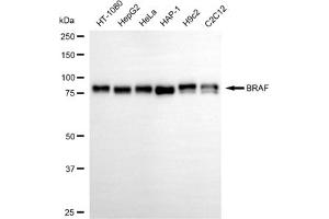 Western blotting analysis using BRAF antibody (ABIN7797725).