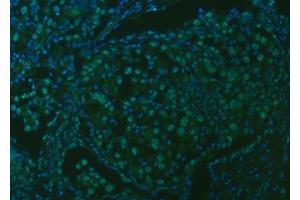 IF analysis of SNRPA1 using anti-SNRPA1 antibody (ABIN7599131).