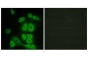 Immunofluorescence analysis of A549 cells, using FXR2 antibody. (FXR2 anticorps)