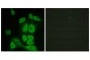 Immunofluorescence analysis of A549 cells, using FXR2 antibody.