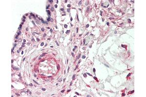 Human Placenta: Formalin-Fixed, Paraffin-Embedded (FFPE)