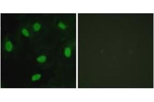 Immunofluorescence analysis of HeLa cells, using TBX15/18 Antibody. (T-Box 15/18 anticorps  (AA 161-210))