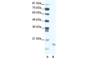 WB Suggested Anti-DIABLO Antibody Titration:  0. (DIABLO anticorps  (C-Term))