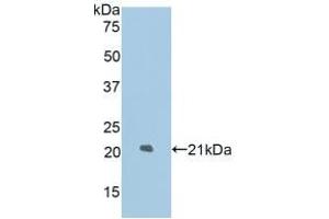 Detection of Recombinant LAMP2, Rat using Polyclonal Antibody to Lysosomal Associated Membrane Protein 2 (LAMP2) (LAMP2 anticorps  (AA 191-362))