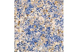 Immunohistochemistry of paraffin embedded mouse spleen using CD30 (ABIN7076073) at dilution of 1:600 (400x lens)