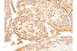 ABIN6267218 at 1/100 staining mouse testis tissue sections by IHC-P.