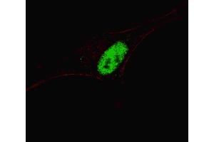 Fluorescent confocal image of SY5Y cells stained with MSX1 (Center) antibody.